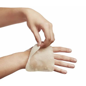 Steroplast Burnshield Dressing 10x10cm – hydrogel burn care application on a hand.